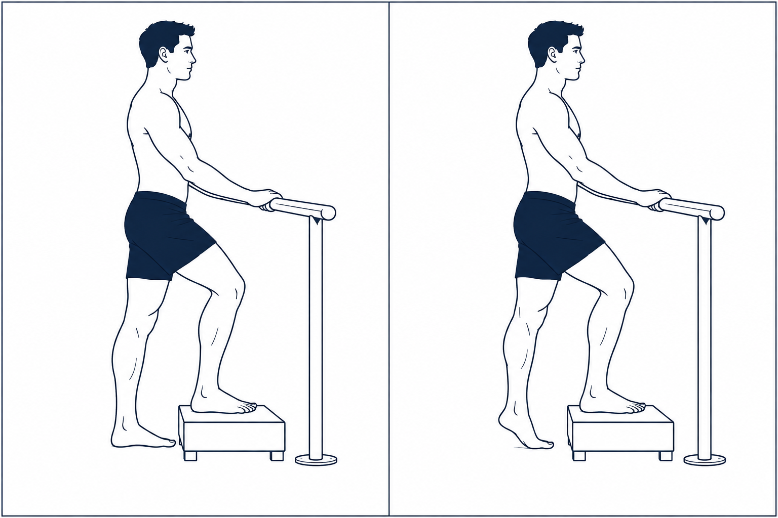 Elevar un talón con ayuda del pie sano en un escalón. El pie sano está arriba; el pie doloroso trabaja siempre sobre suelo plano.